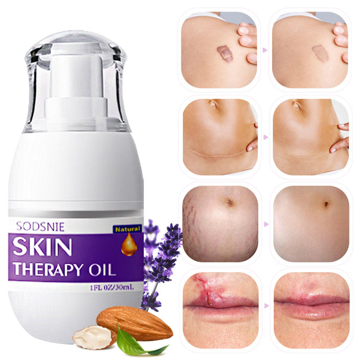 Skin Therapy Oil Scars and Stretch Marks Removal Serum Moisturizing Firming Body Care